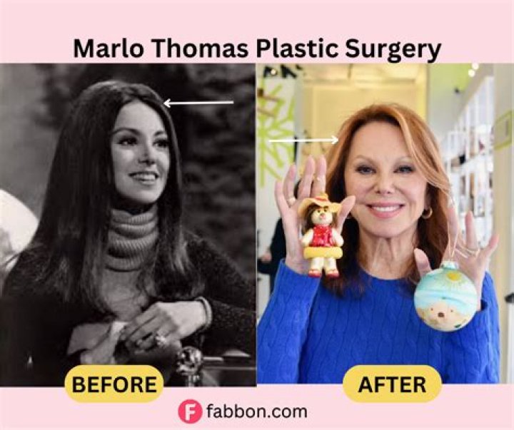 Unveiling The Secrets Of Marlo Thomas's Net Worth